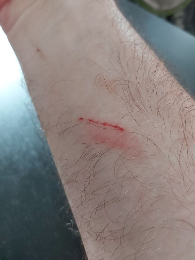 Scratched Arm